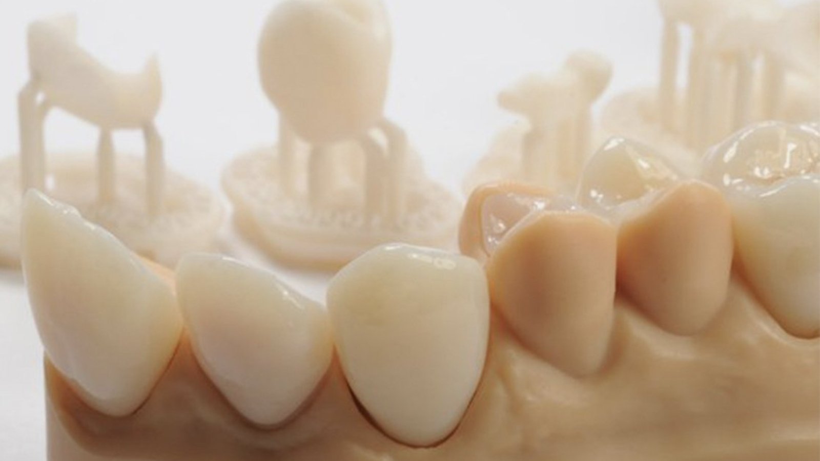 Dental-crowns-cover-image